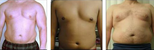Male Overweight
